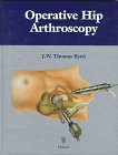 Operative Hip Arthroscopy