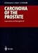 Books : Carcinoma of the Prostate: Innovations in Management