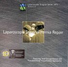 Inguinal-Hernia