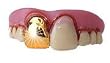 Slick Ray Billy Bob Costume Teeth - Pimp Costume Teeth - Great Unisex Costume Accessory