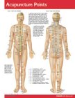 Acupuncture