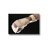 FREEDOM Progressive Resting Splint Progressive Splint with AliFleece Glove, Left, Sm/Med.