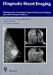 Book Diagnostic Breast Imaging: Mammography, Sonography, Magnetic Resonance Imaging, and Interventional Procedures
