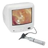 Welch Allyn 23100 CompacVideo Otoscope Head