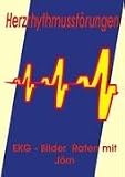 Herzrhythmusstörungen: EKG - Bilder Raten mit Jörn