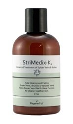 spider vein treatment