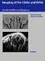 Imaging of the Globe and Orbit: A Guide to Differential Diagnosis