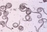 Classic Trichinosis Film