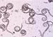 Classic Trichinosis Film