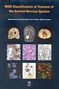 WHO Classification of Tumours of the Central Nervous System (IARC WHO Classification of Tumours) (v. 1)