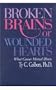 Broken Brains or Wounded Hearts: What Causes Mental Illness
