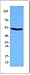 645701 - Size : 25 micrograms - Anti-p53 Mouse Monoclonal Antibody () [Clone: DO-1] - Each