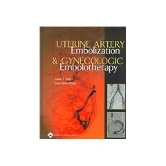 Uterine Artery Embolization and Gynecologic Embolotherapy by James B. Spies and Jean-Pierre Pelage