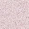 Pink Shimmer