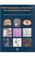 WHO Classification of Tumours of the Central Nervous System
