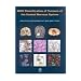 WHO Classification of Tumours of the Central Nervous System (IARC WHO Classification of Tumours) (v. 1)