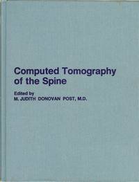 Computed-Tomography