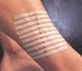 3M Steri-Strip Skin Closures, Reinforced