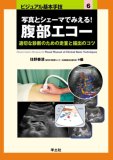 写真とシェーマでみえる!腹部エコー―適切な診断のための走査と描出のコツ (ビジュアル基本手技 6)