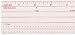 PICA RULER WITH CENTER SCALE