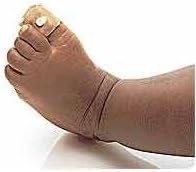 Puritan Bennett Oxiband Reusable Sensor, Pediatric/ Infant (PBOXIPI) Category: Cannulas and Tracheostomy Supplies