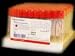 BD 5ml Blood Test Tube 100 COUNT
