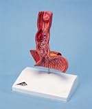 Diseases of the Esophagus