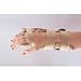 3-Point Comforter Splint eases active rheumatoid arthritis pain by cradling the hand and wrist in neutral alignment. Thick Kydex shell positions the wrist in slight extension, holding MP joints in neutral and allowing IP function. Soft, quilted splint cover. Adjustable, padded finger and wrist stays for perfect alignment. CMC joint is supported, allowing thumb to function freely. Neoprene straps with finger holes facilitate splint application and strap adjustment. Sizing: Measure MP joints across dorsal surface from radial side of second metacarpal to ulnar side of fifth metacarpal. UL> X-Small: 2 " - 2 5/8" Small: 2 5/8" - 3 1/8" Medium: 3 1/8" - 3 " Large: 3 " - 3 5/8" Specify size and Left or Right.