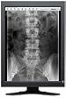 EIZO RadiForce GS220 - LCD display - 2MP - grayscale - TFT - 21.3 - 1600 x 1200 - 1000 cd/m2 - 850:1 - 23 ms - 0.27 mm - DVI-D - black