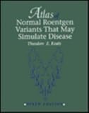 Atlas of normal roentgen variants that may simulate disease