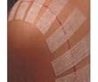 3M Steri-Strip Reinforced Skin Closure 1"X5" - Box of 100 - Model r1548