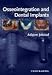 Osseointegration and Dental Implants