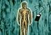 Classic Medical Aspects of Radiation Films