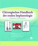 Chirurgisches Handbuch der oralen Implantologie: Praktische Arbeitsschritte