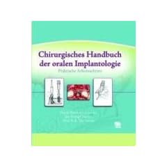 Chirurgisches Handbuch der oralen Implantologie: Praktische Arbeitsschritte
