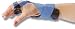 Long Ulnar Deviation Wrist Splint, Left, Large