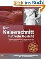 Der Kaiserschnitt hat kein Gesicht