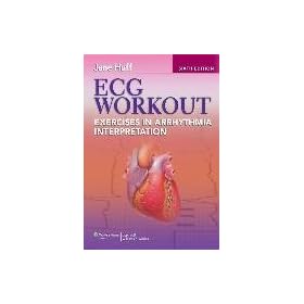 ECG Workout Exercises in Arrhythmia Interpretation Softbound