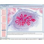 Illustrated Resource Library - Cell Division (Mitosis and Meiosis) CD ROM
