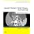 Gastrointestinal Imaging: Case Review Series