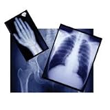 Buy EZQF5 PT# EZQF5- Film X-Ray GPlus 14x17 100 Bx by, Agfa Corporation