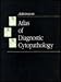 Atlas of Diagnostic Cytopathology, 1e at Amazon Books: 21o6UWWGiHL._SL75_