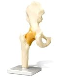 Anatomical Models - Hip Joint, Functional
