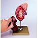 Somso Kidney and Adrenal Gland