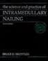 The Science and Practice of Intramedullary Nailing