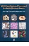 Who Classification of Tumours of the...