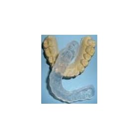 Click here to buy Professional Custom Soft Teeth Night Guard. SLEEP RIGHT, Prevent Teeth Grinding(Bruxism).... by Sparklng White Smiles.