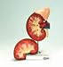 Human Kidney Model with Adrenal Gland, Two Parts