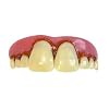 Megabucks Teeth - Billy Bob(R)