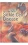 Sickle Cell Disease (Just the Facts (Heinemann))